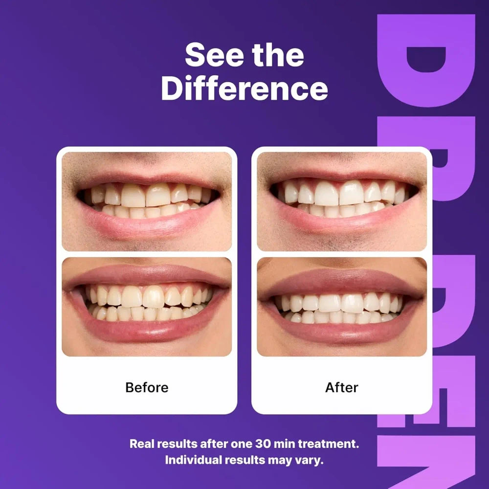 Purple Teeth Whitening Strips